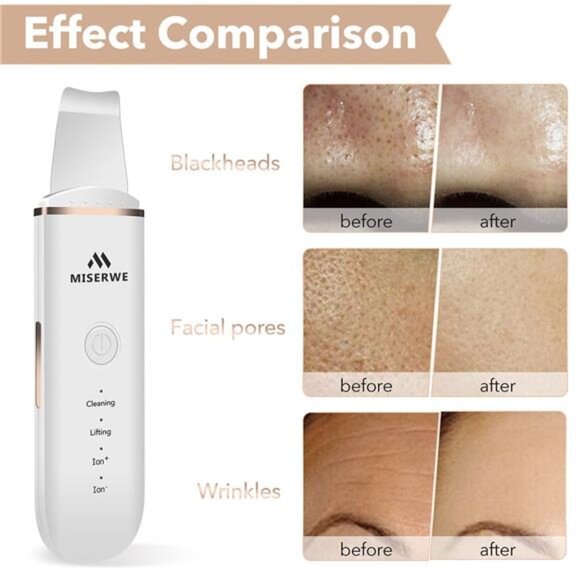 Skin Scrubber Face Skin Spatula Facial Scrubber Spatula for Deep Cleansing - Picture 5 of 7